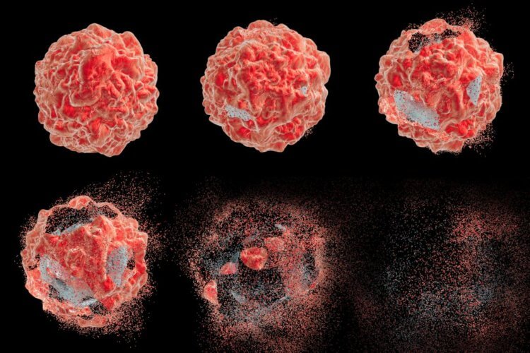 Шотландские ученые изобрели способ, с помощью которого можно убивать раковые клетки. Шотландские ученые провели успешное испытание препарата, который способен убивать раковые клетки, не повреждая расположенные рядом здоровые ткани. Фото.