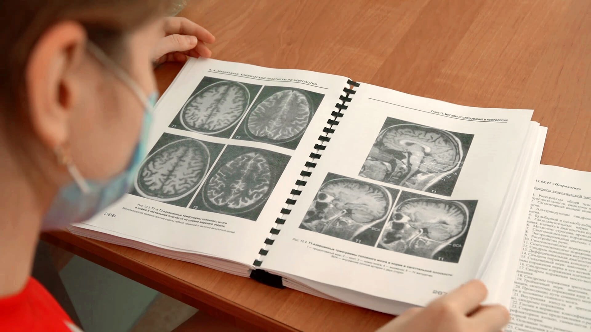 Новый коронавирус, согласно еще одному предположению ученых, способен вызвать опухоль мозга и ускорить развитие уже имеющейся. Фото.