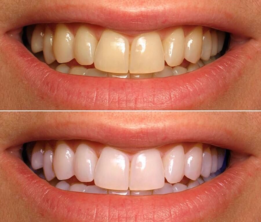 Новые конфеты также могут отбеливать зубы. Фото.