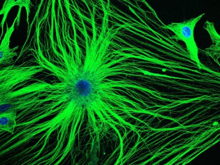 Проникновение в мозг. Перед вами ярко-зеленые клетки со множеством ответвлений и синими ядрами. Астроциты – это звездообразные клетки центральной нервной системы, которые выполняют множество функций, в том числе обеспечивают нейроны питательными веществами. Фото.