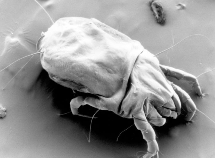 Какие бактерии и насекомые скрываются в вашем постельном белье?