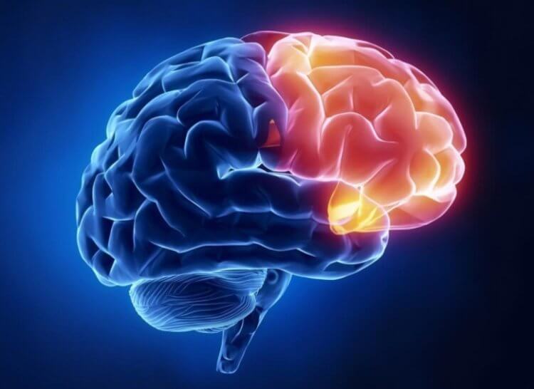 Влияние хронической боли на мозг. Префронтальная кора головного мозга. Фото.