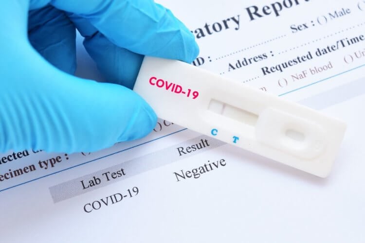 Тестирование на коронавирус. Экспресс-тест на коронавирус показывает одну полоску, если результат отрицательный и две – положительный. Как на беременность. Фото.