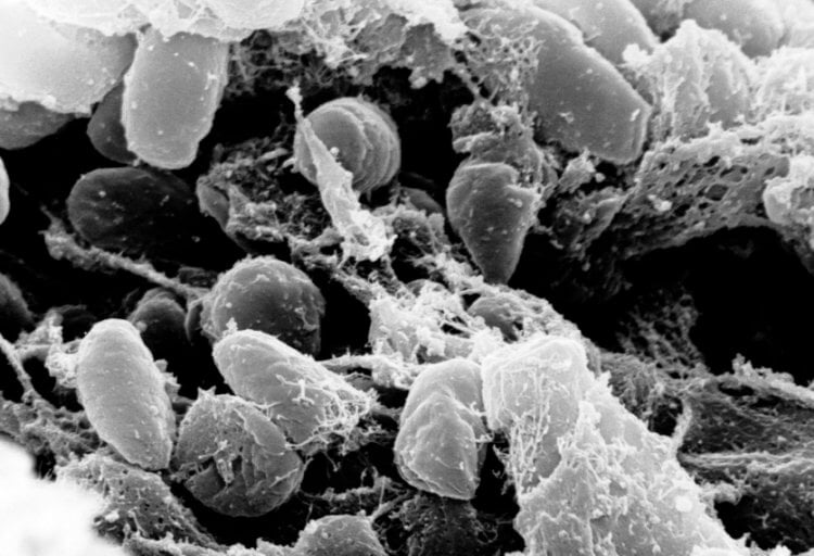 Чума в современном мире. Бактерии вида Yersinia pestis, также известные как чумная палочка. Фото.
