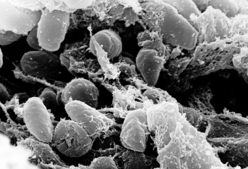 Бактерии вида Yersinia pestis, также известные как чумная палочка. Фото.