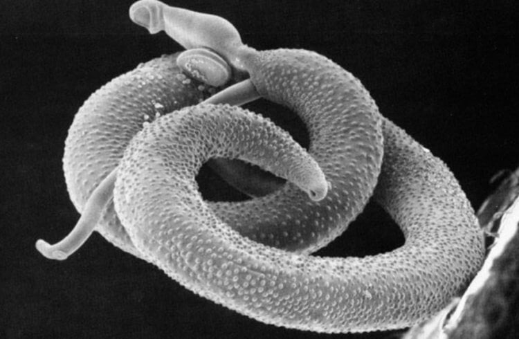 Что такое шистосомоз? Паразитический червь вида Schistosoma. Фото.