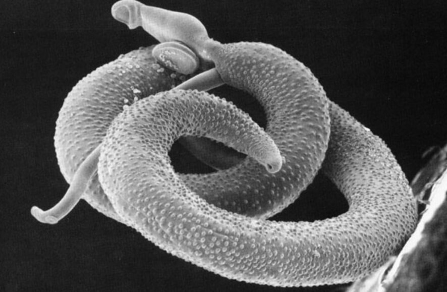 Что такое шистосомоз? Паразитический червь вида Schistosoma. Фото.