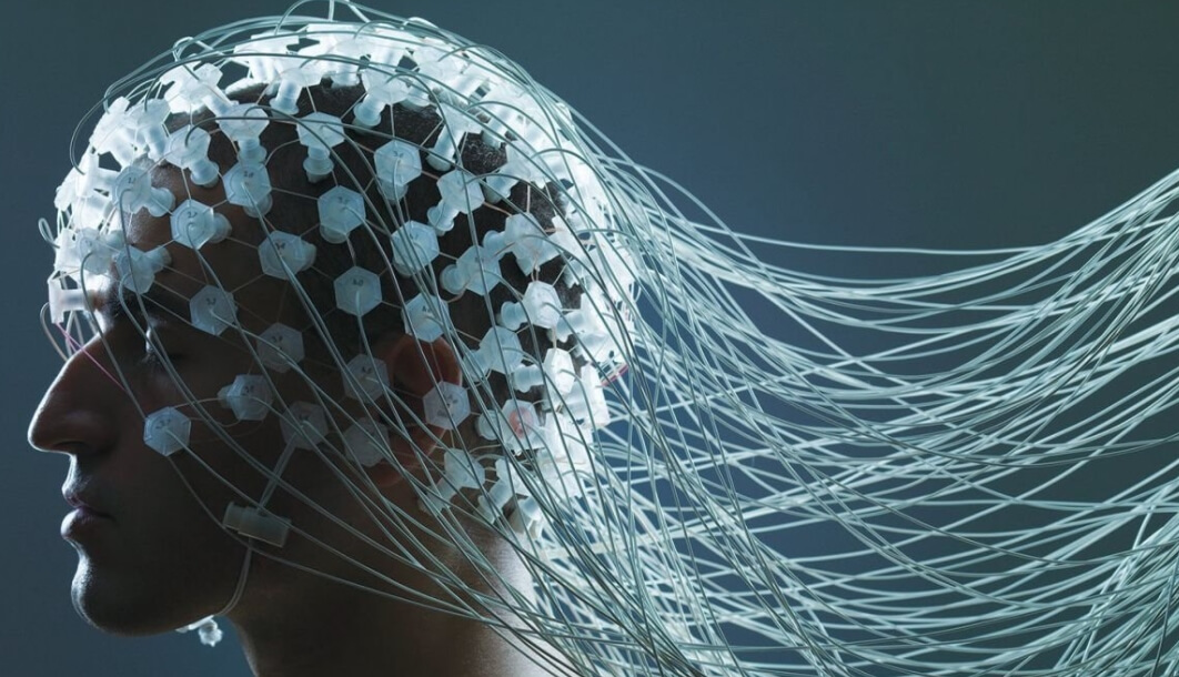 Можно ли загрузить мозг в компьютер — и стоит ли пытаться? Разработкой интерфейса мозг-компьютер помимо Neuralink занимаются и другие компании. Фото.