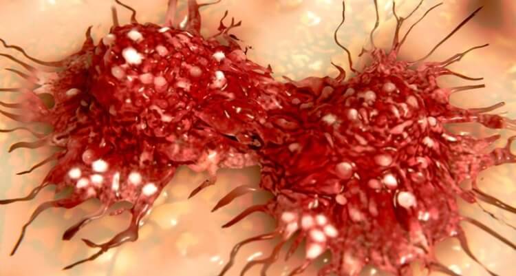 Как появляются устойчивые к химеотерапии клетки. После химиотерапии некоторые раковые клетки сохраняют способность делиться. Фото.