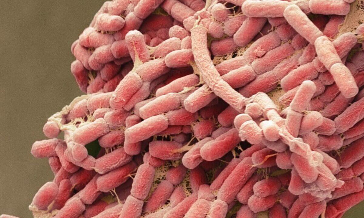 Секрет вечной молодости в кишечных бактериях? Кишечная палочка — распространенная бактерия кишечной микрофлоры. Фото.