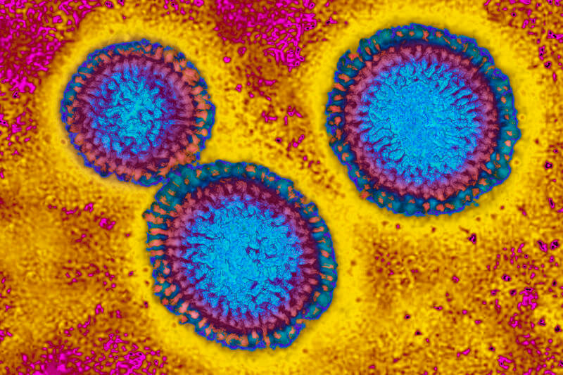 Вирус гриппа под микроскопом. Его диаметр колеблется примерно от 80 до 120 нм.