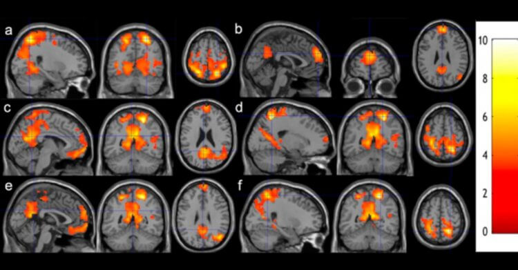 Польза медитации. Результаты сканирования мозга студентов. Фото.