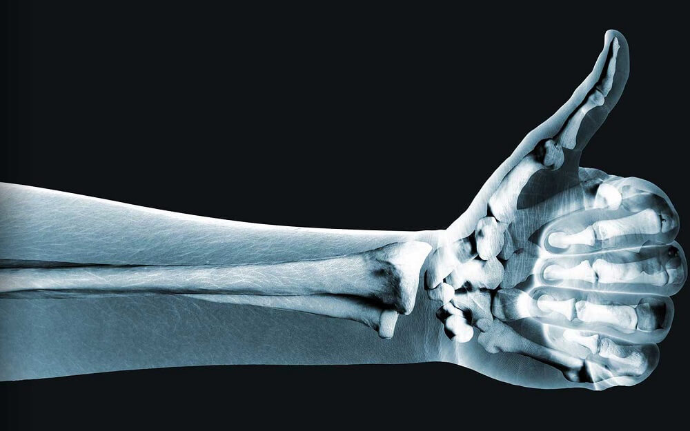 При нормальном питании кофе не повлияет на количество кальция в костях. Фото.