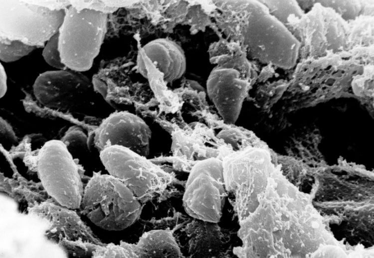 Как распространяется чума? Чумные палочки Yersinia pestis под микроскопом. Фото.