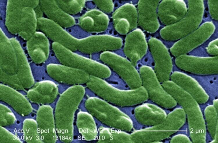 Опасность морепродуктов и грязной воды. Бактерии Vibrio vulnificus. Фото.