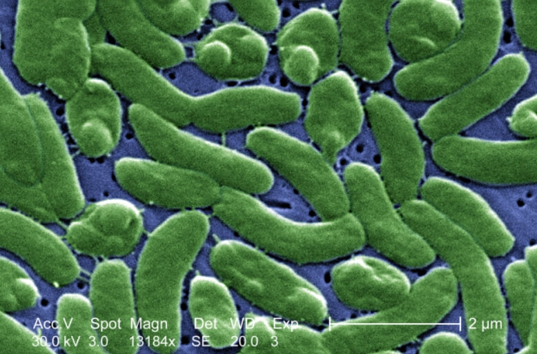 Опасность морепродуктов и грязной воды. Бактерии Vibrio vulnificus. Фото.