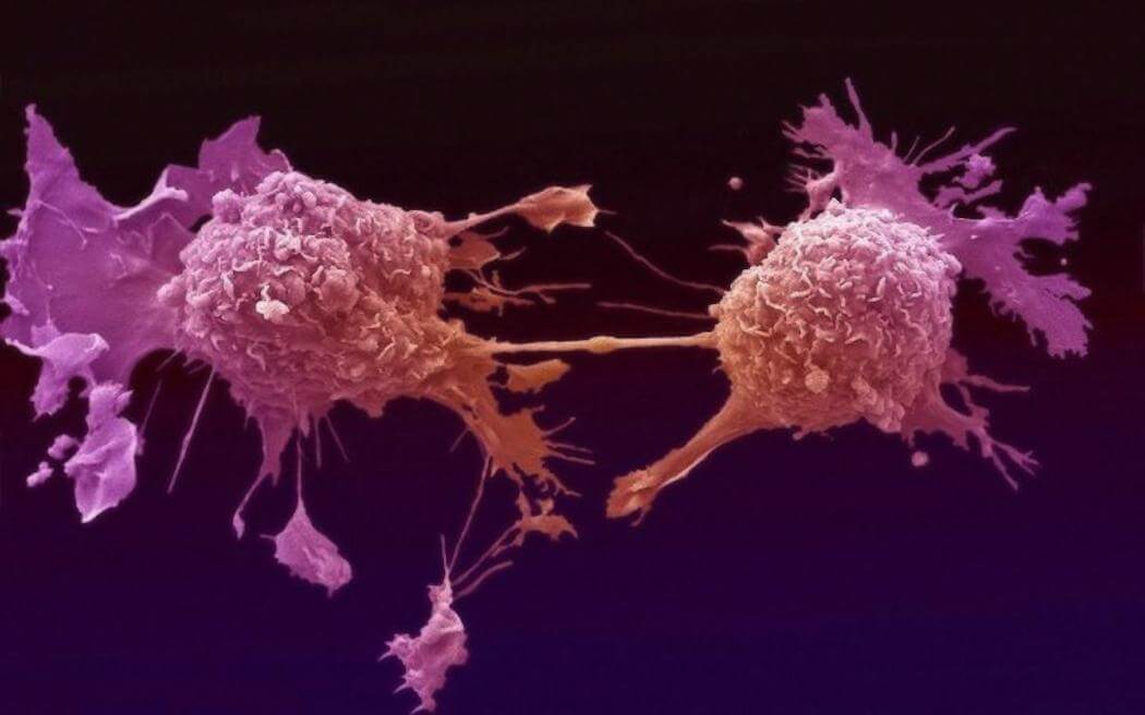 Иммунная система слепышей уничтожает злокачественные клетки сразу же, как только они начинают делиться. Фото.