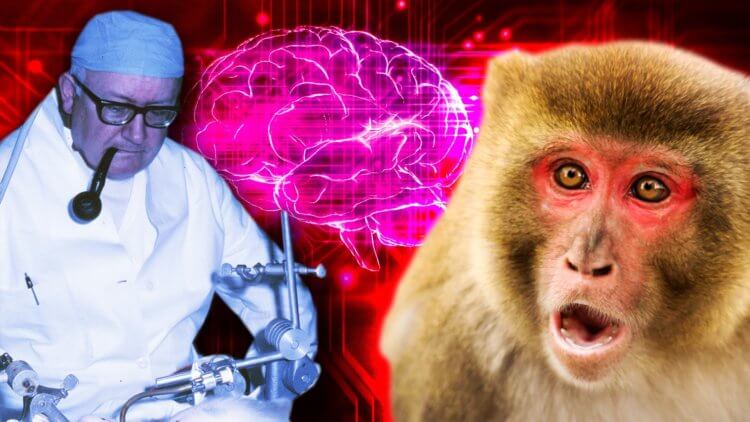 Пересадка головы: реальность, фантастика и наука. Когда-то трансплантация органов считалась невозможной. Но сегодня ученые пересаживают головы летучим мышам и даже обезьянам. Фото.