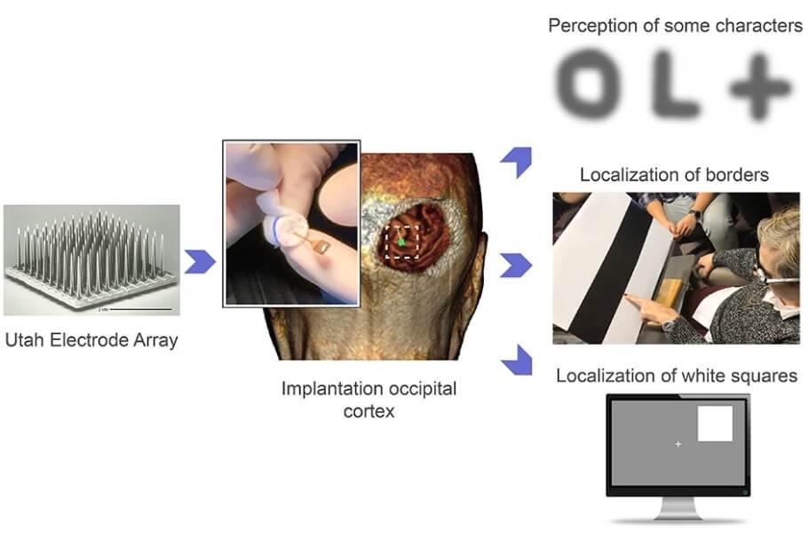 Спустя некоторое время Берна Гомес смогла различить, в каком углу монитора появляется светлый квадрат. Фото.