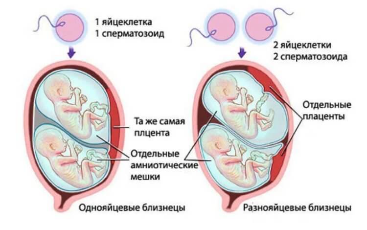 В рождении однояйцевых близнецов виновата эпигенетика. Однояйцевые близнецы возникают по непонятной для ученых причине из одной яйцеклетки. Фото.