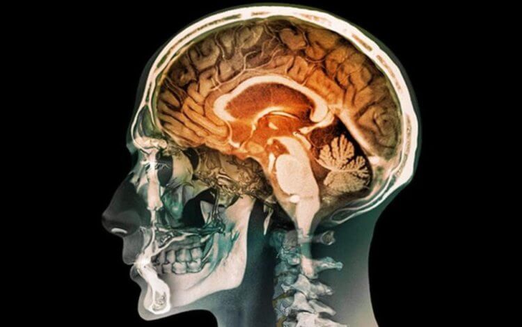 Как космос влияет на головной мозг? Космические путешествия могут негативно сказаться на здоровье головного мозга. Фото.