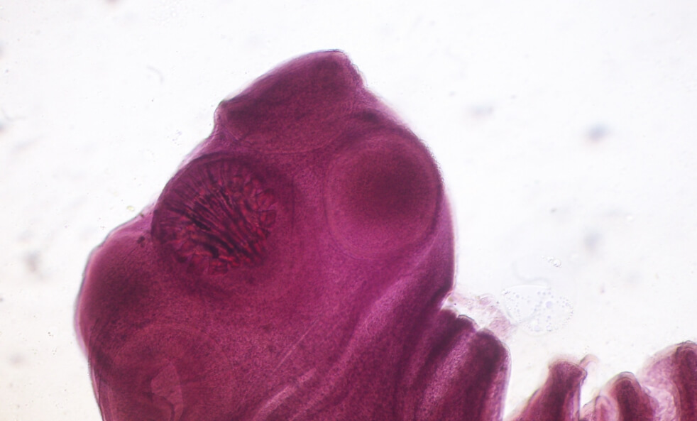 Опасность свиных цепней. Свиной цепень под микроскопом. Фото.