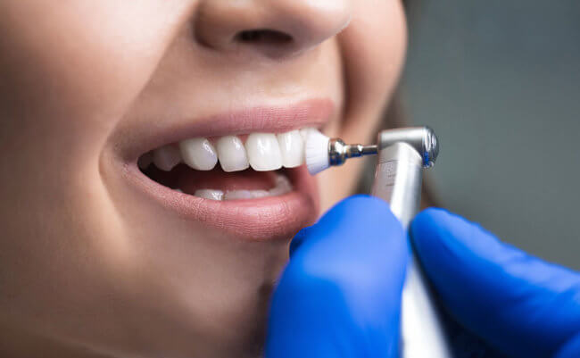 Какие бывают зубные щётки и почему их недостаточно для правильной чистки. Фото.