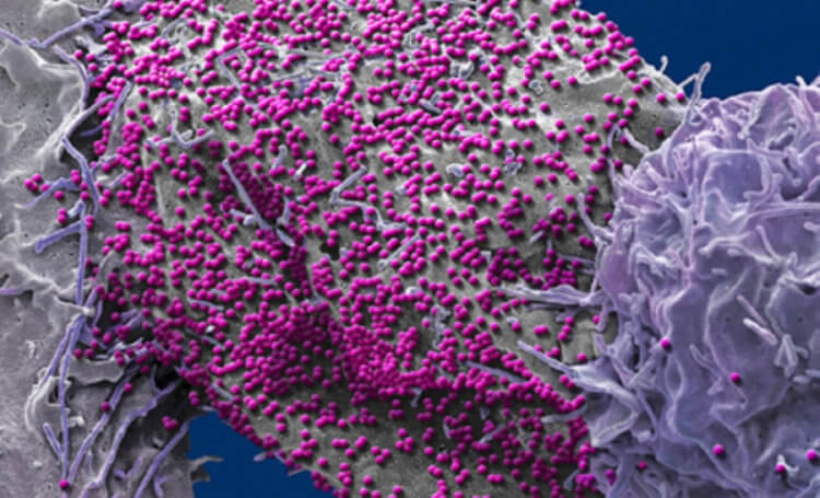 Как сероводород помогает против ВИЧ. Ученые нашли вещество, которое поможет в борьбе с ВИЧ. Фото.