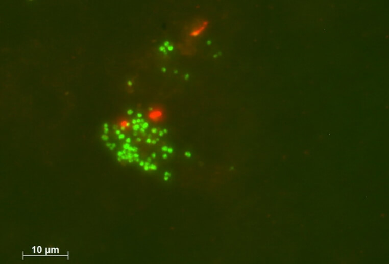 Бактерии Candidatus Methanoliparia, которые научились самостоятельно перерабатывать нефть. Фото.