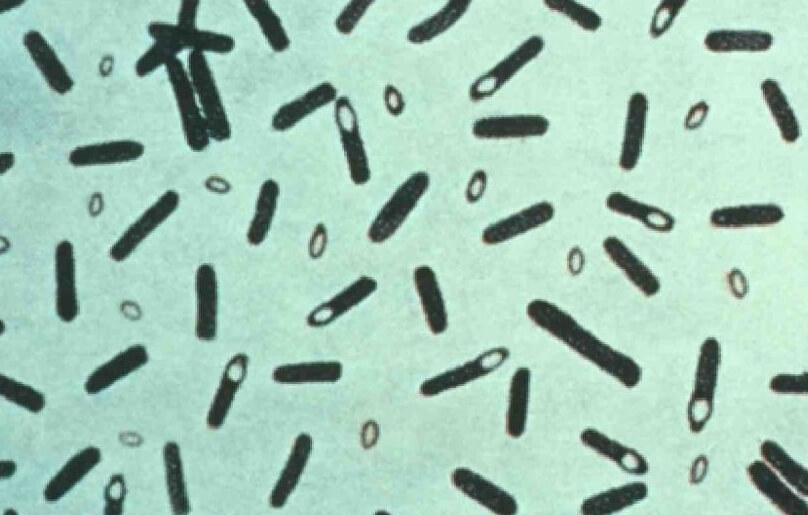 Бактерии Clostridium botulinum, из которых получается ботулотоксин. Фото.