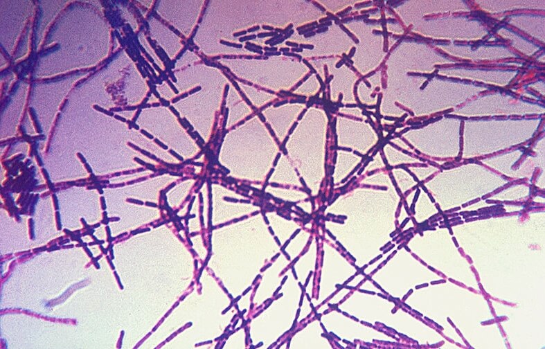 Bacillus anthracis под микроскопом. Фото.