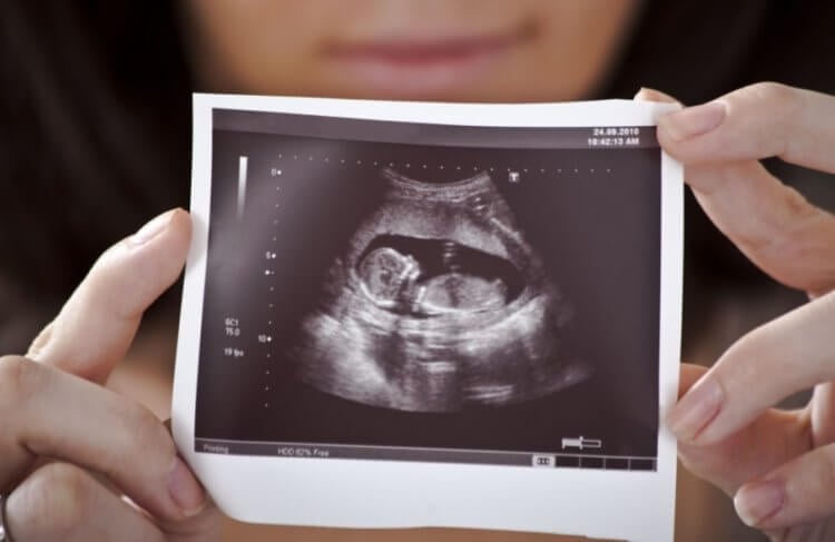 Почему безымянный палец длиннее указательного? Пальцевый индекс можно определить даже у ребенка, находящегося в утробе матери. Фото.