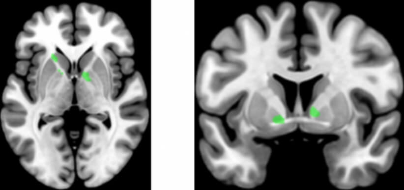 За речевые способности и моторику рук отвечает один и тот же участок мозга. Фото.