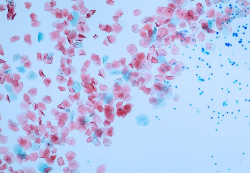 Микропластик под микроскопом. Фото.