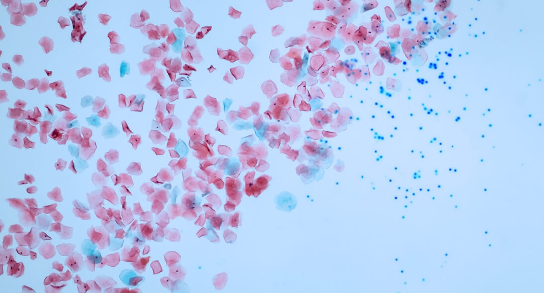 Микропластик содержится не только в воде, но и в воздухе. Фото.