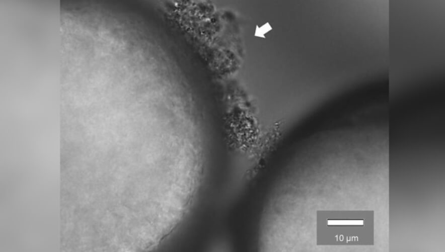 Микробы на поверхности микропластика. Фото.