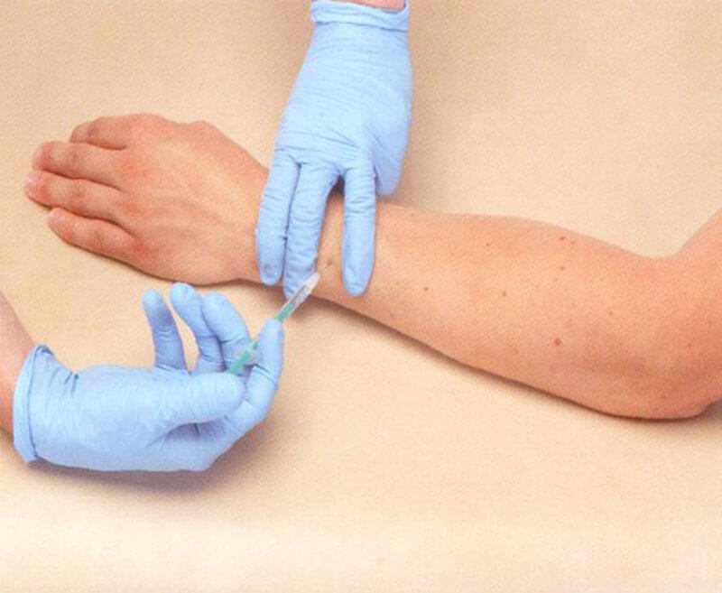 Ботокс устраняет тревогу. Ботокс применяется не только в косметологии, но и невралгии. Фото.