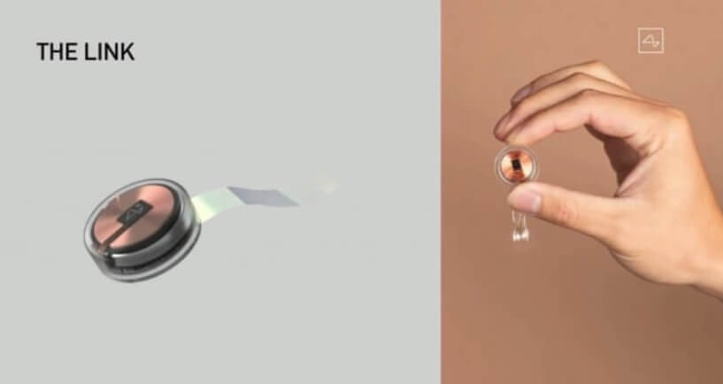 Внешний вид чипа Neuralink. Фото.