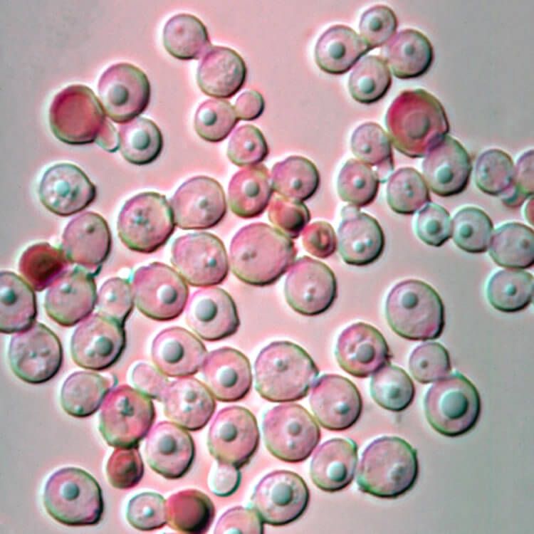 Ученые открыли новые для науке бактерии. Грибки Malassezia globosa. Фото.