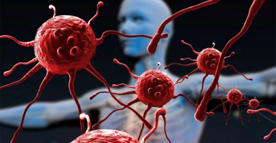 Омикрон мог появиться в организме человека с ослабленным иммунитетом, предположительно, инфицированным ВИЧ. Фото.