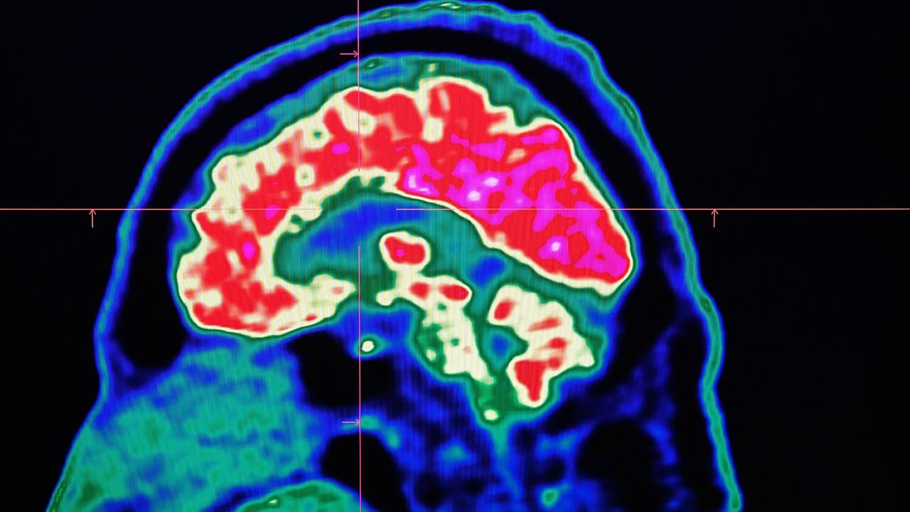 Чтобы обработать огромное количество визуальной информации, мозг отправляет нас назад во времени. Фото.