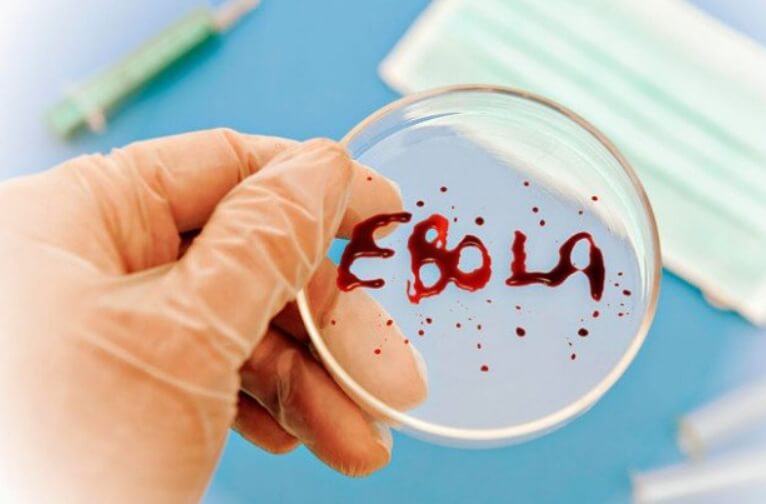 Лихорадку Ласса легко спутать с другими заболеваниями. Фото.