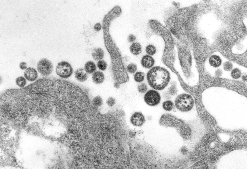 Возбудитель болезни Ласса под микроскопом. Фото.
