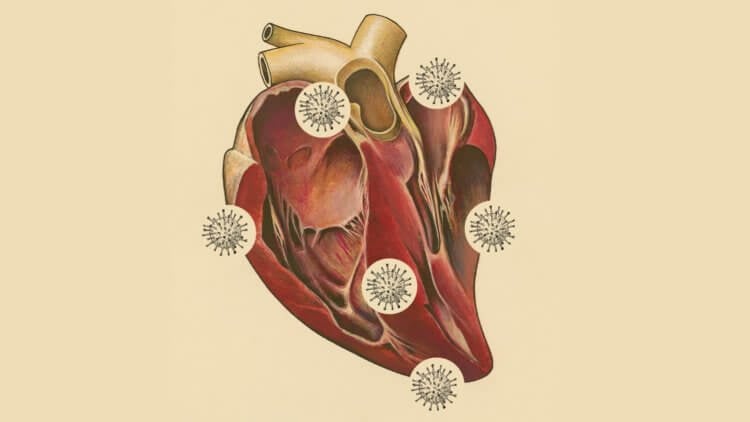 Какой удар COVID-19 наносит организму? Ковид бьет по всему организму включая сердце, мозг и легкие. Фото.