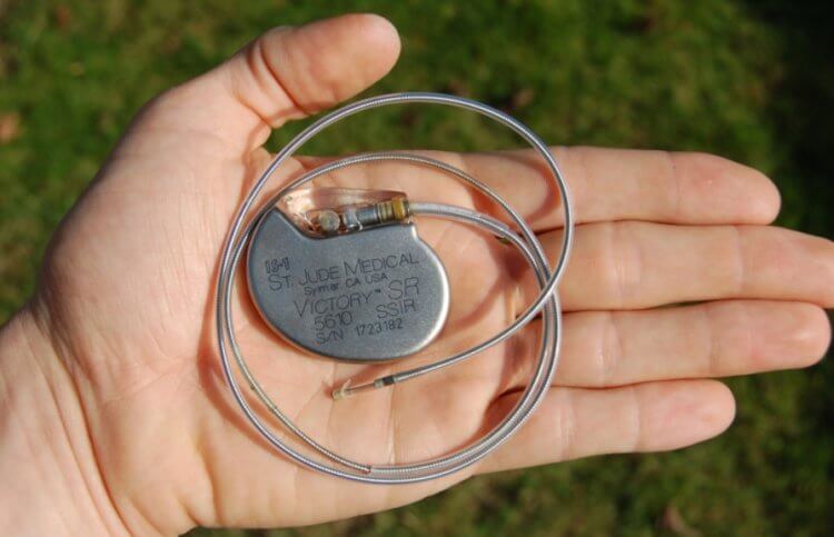 Для чего нужны маленькие батарейки? Современные кардиостимуляторы потребляют минимум энергии. Фото.