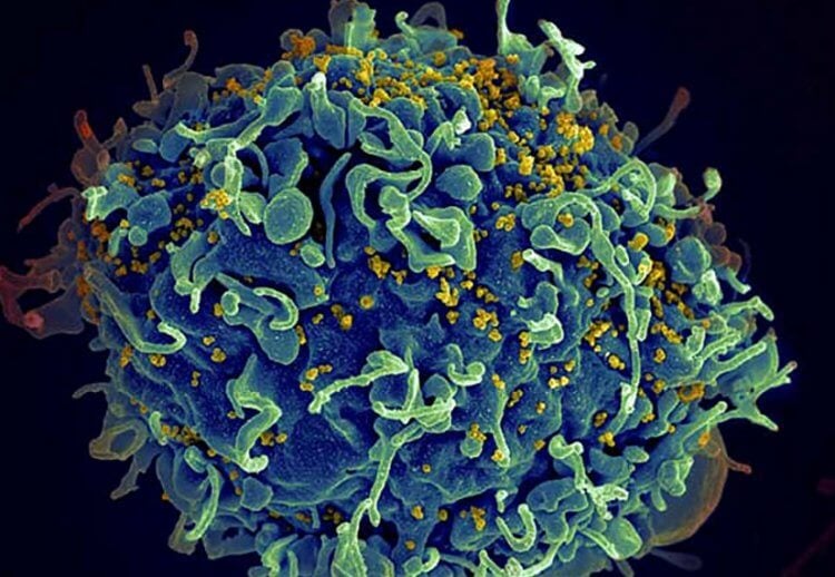 Особенности воздействия биологического оружия. Ученым до сих пор не удалось найти способ побороть вирус ВИЧ. Фото.