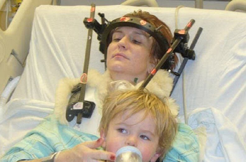 Шеннон Маллой во время лечения. Фото.