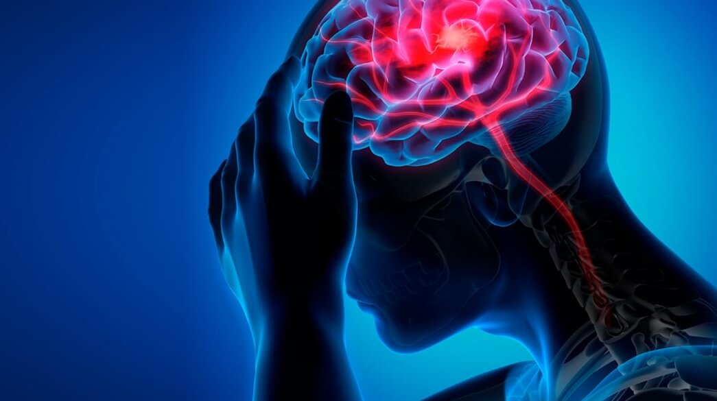 Влияние антибиотиков на головной мозг. Антибиотики необъяснимым образом ухудшают когнитивные способности людей. Фото.