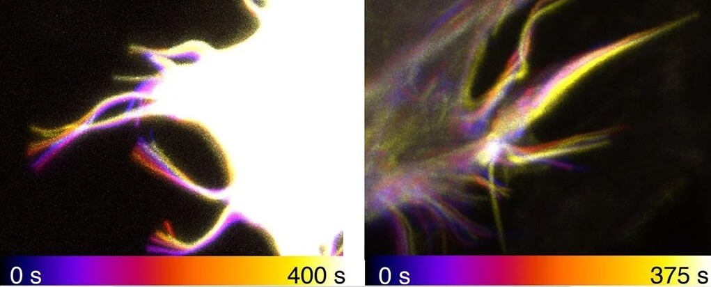 Как человечество борется с раком? На фотографиях можно увидеть, как двигаются филоподии. Фото.