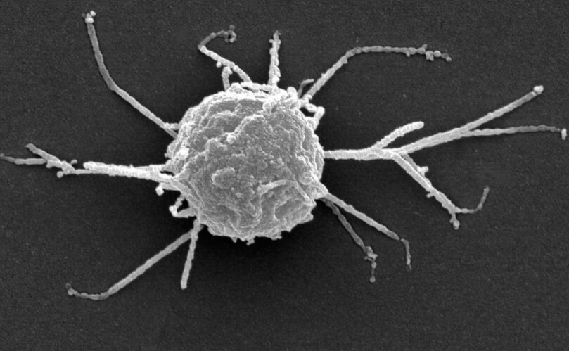 Как двигаются клетки? Отростки раковой клетки. Фото.